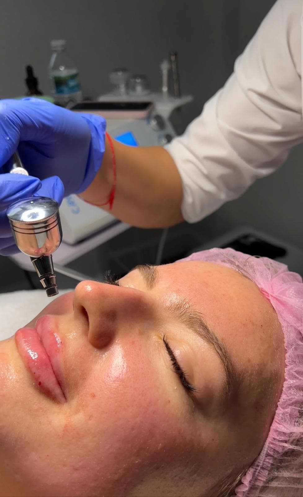 Renew and Refresh Your Skin: PRX-T33 Renewal Therapy